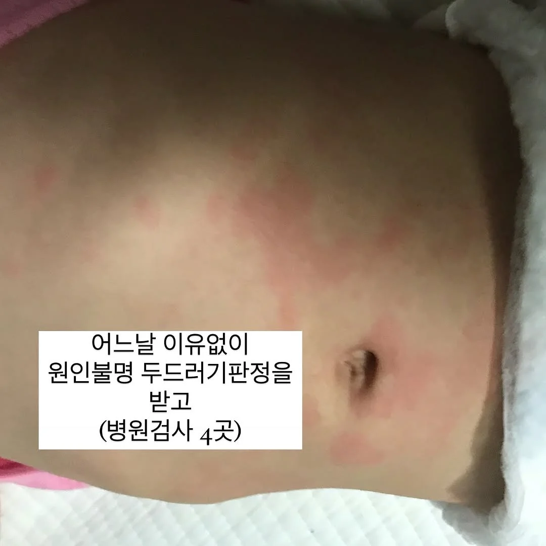 빅샵 인기 세트 2