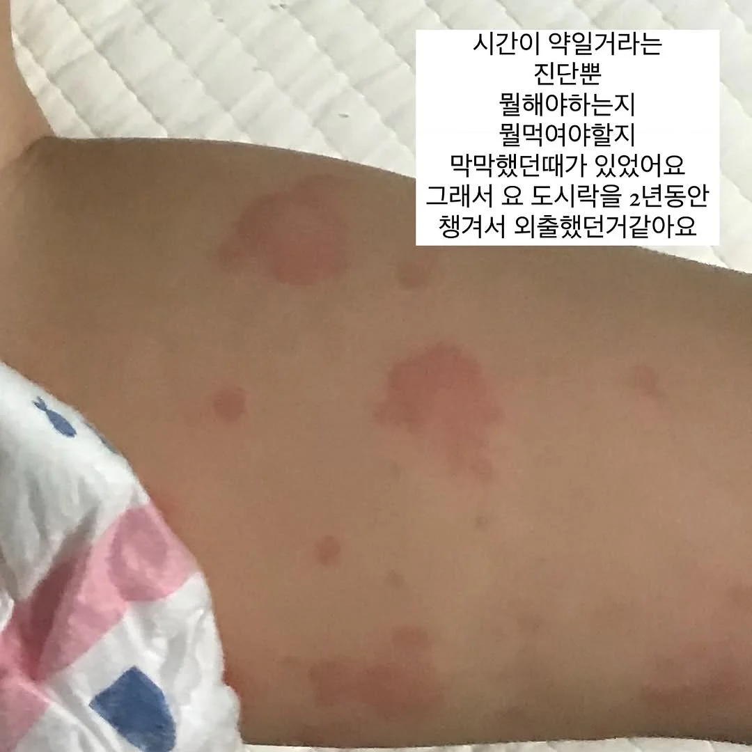 빅샵 인기 세트 3