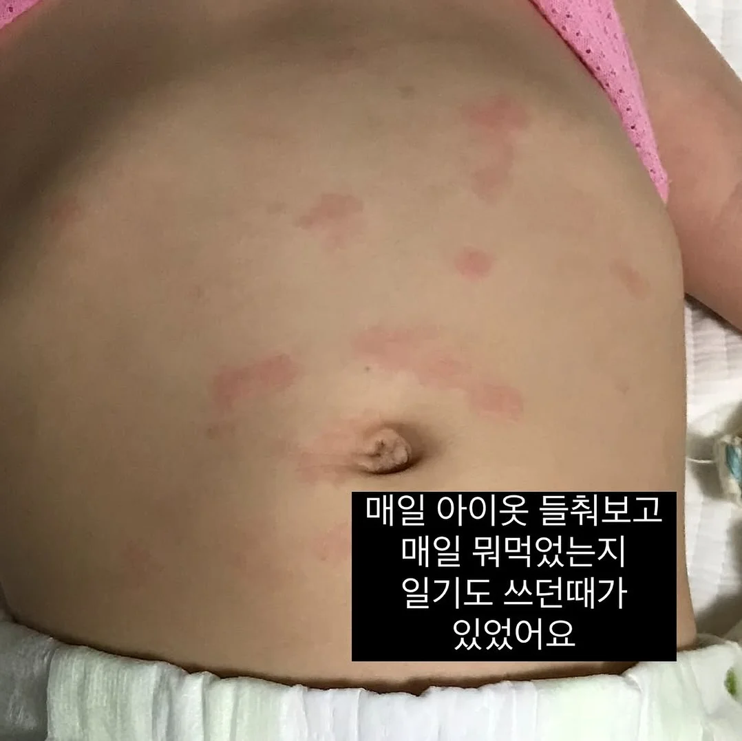 빅샵 인기 세트 4