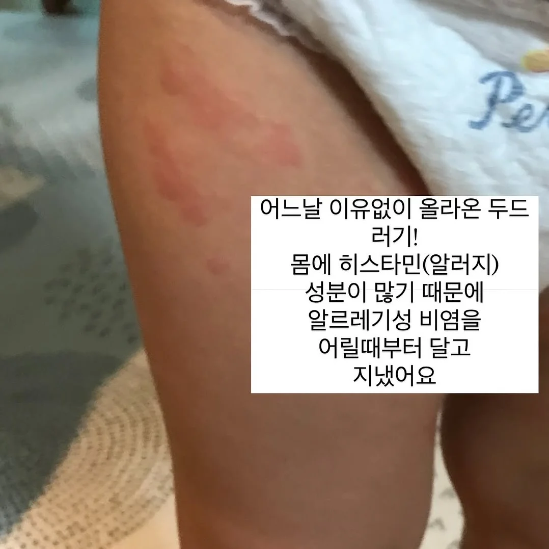 빅샵 인기 세트 5
