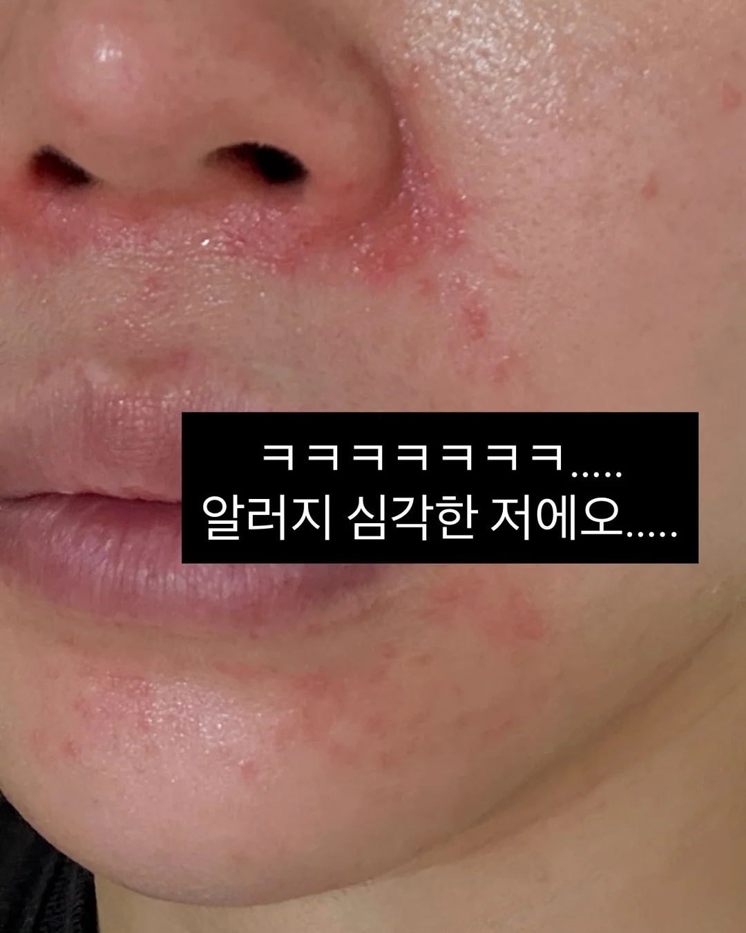 야구장도시락 7