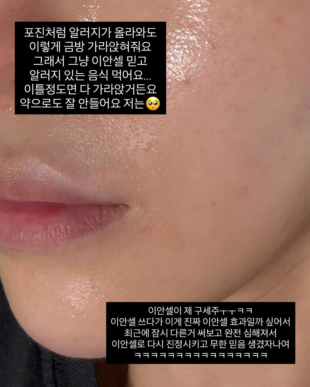 야구장도시락 8