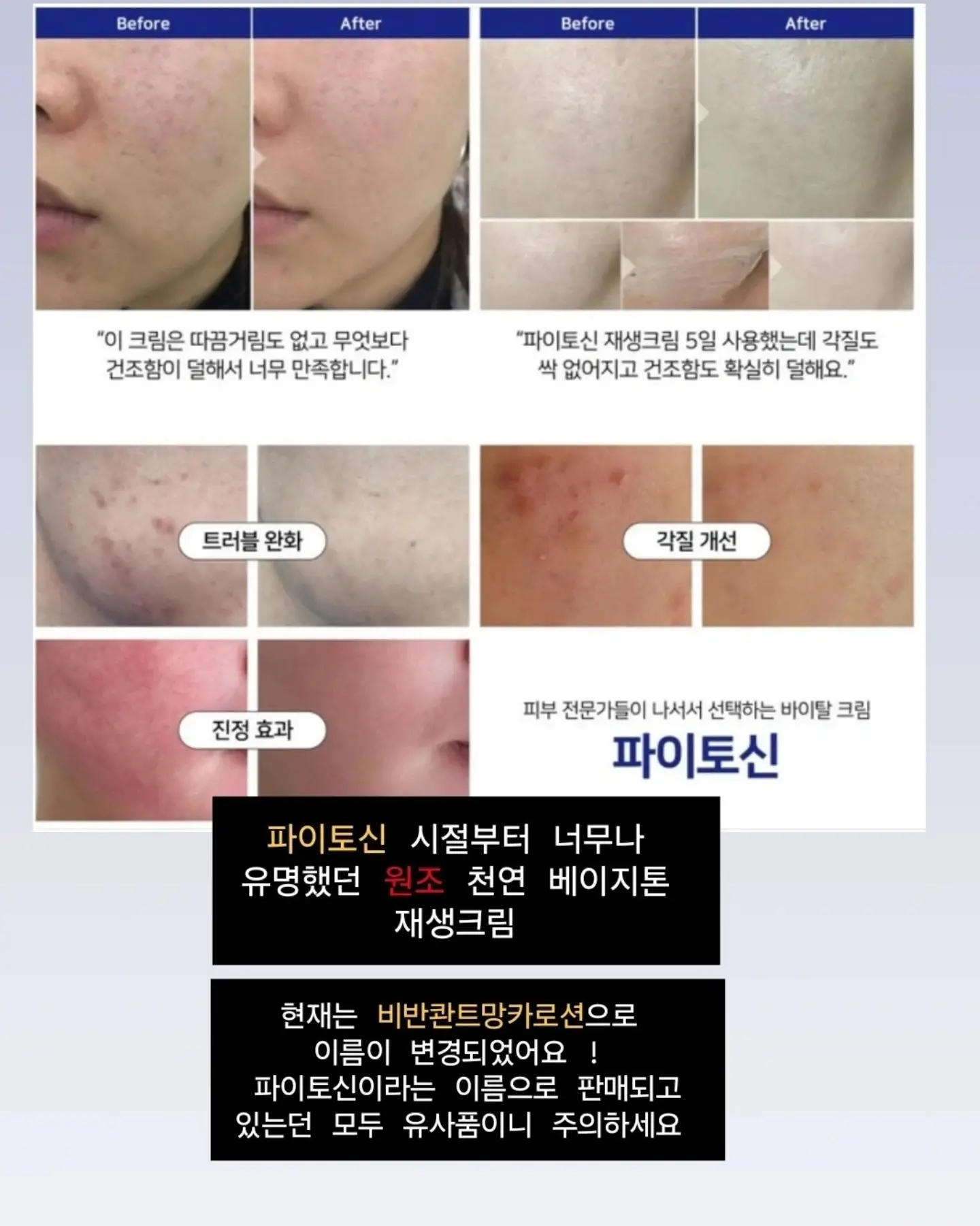 모델로 UV 프로텍션 마스크 4