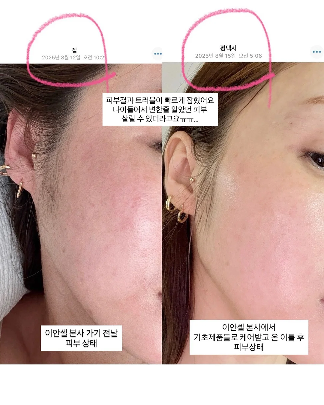 케어리브 반창고 1