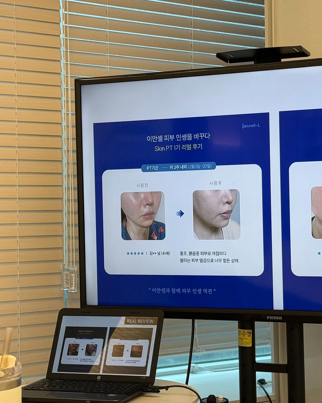 케어리브 반창고 4
