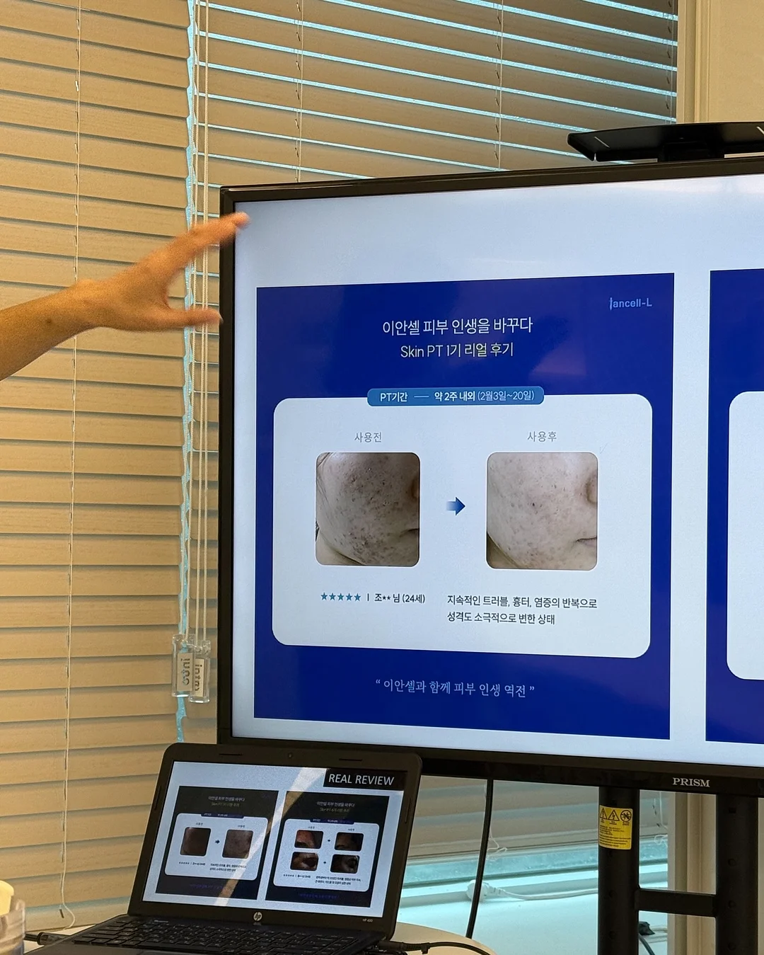 케어리브 반창고 5