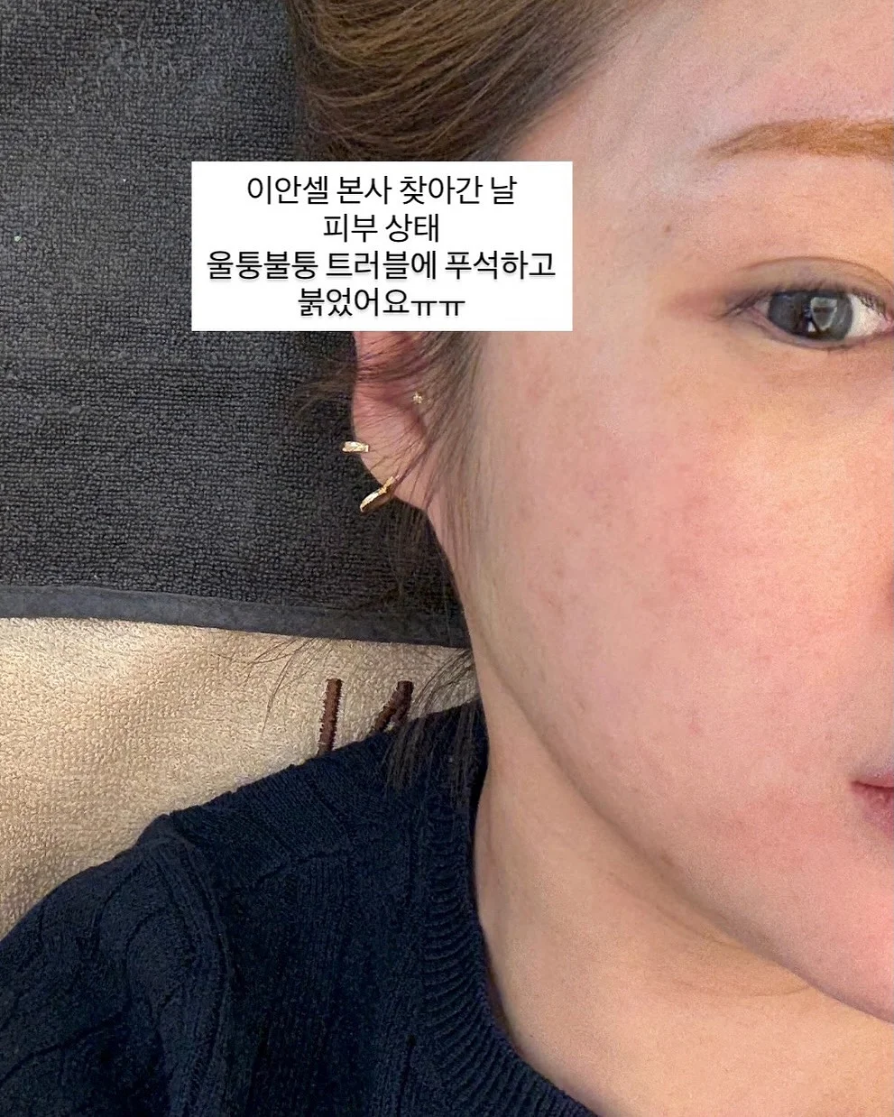 케어리브 반창고 7