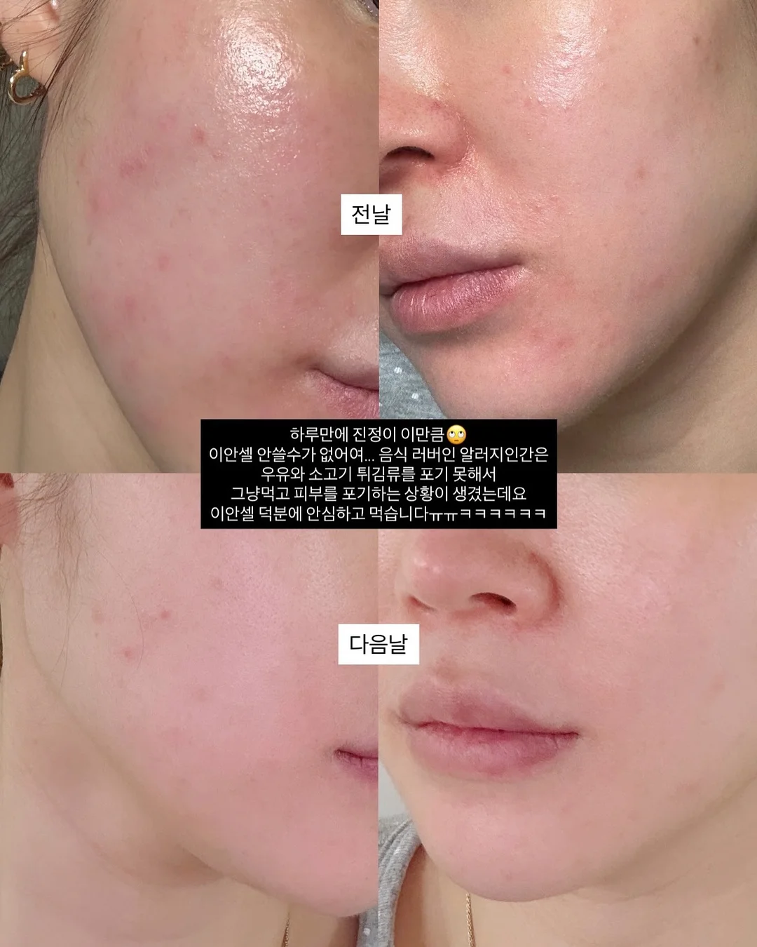 케어리브 반창고 8