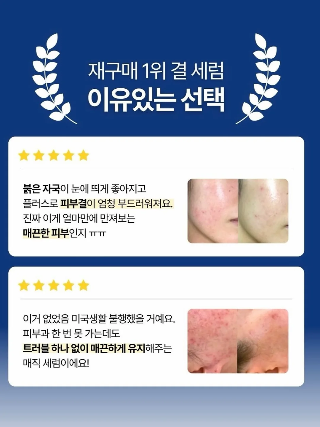 대용량 닭다리 과자 4