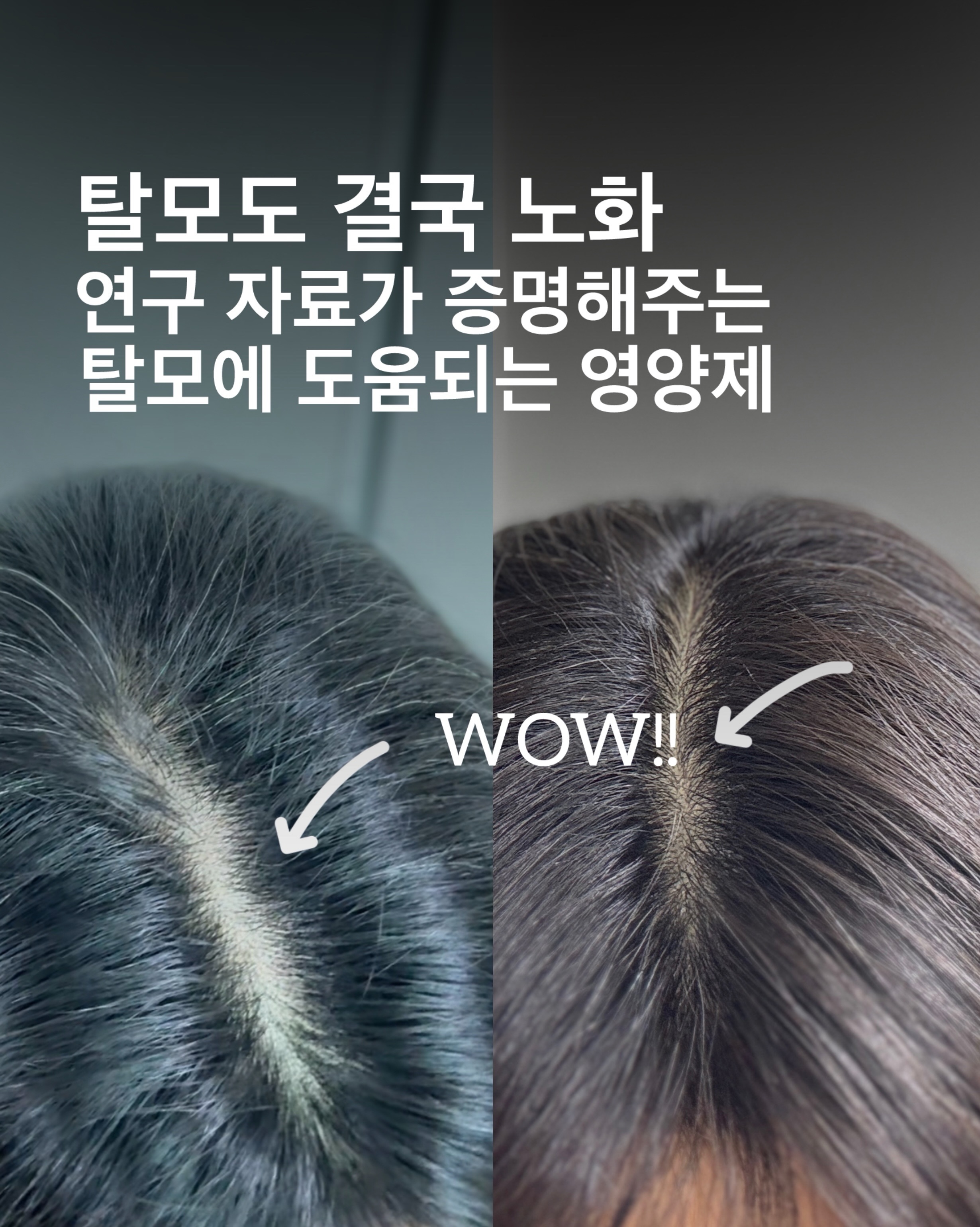 오뜨베베 나시고쟁이상하세트 1