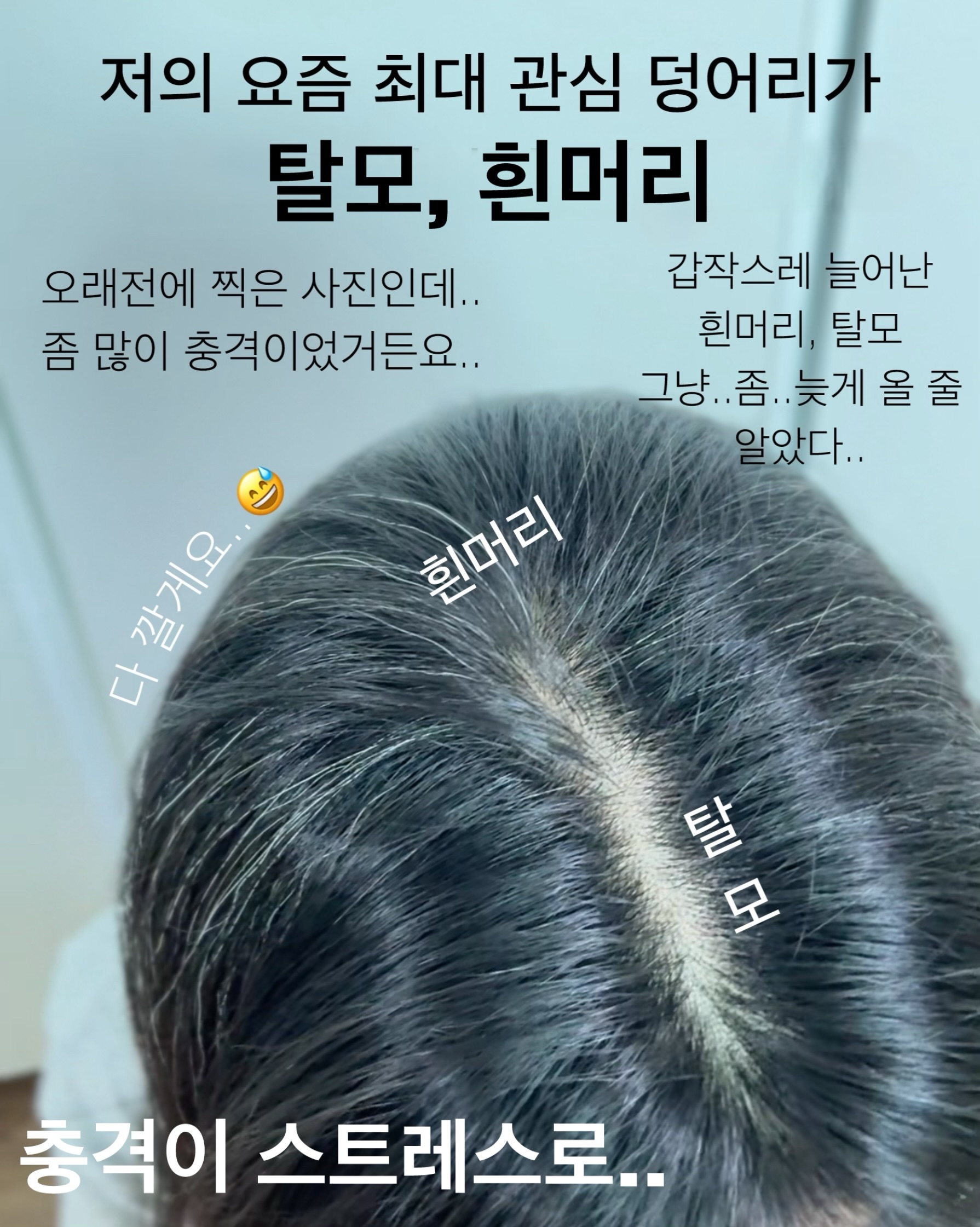 오뜨베베 나시고쟁이상하세트 2