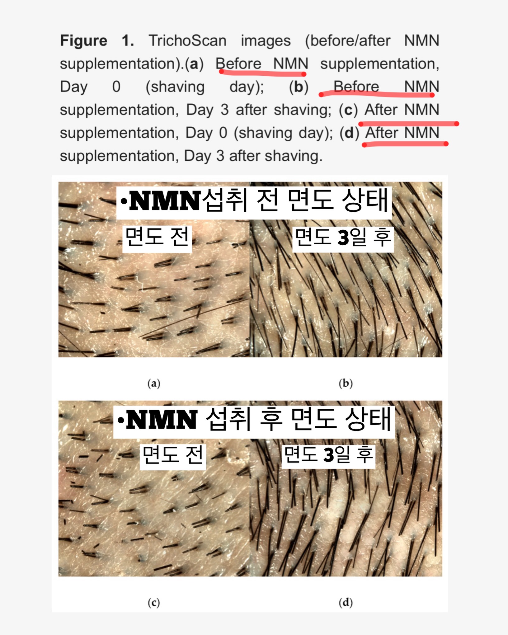 오뜨베베 나시고쟁이상하세트 11