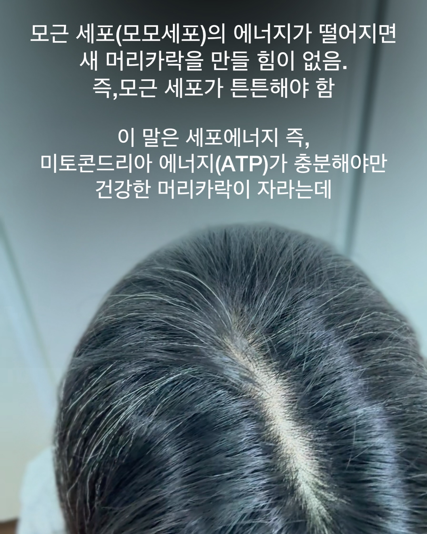 오뜨베베 나시고쟁이상하세트 6