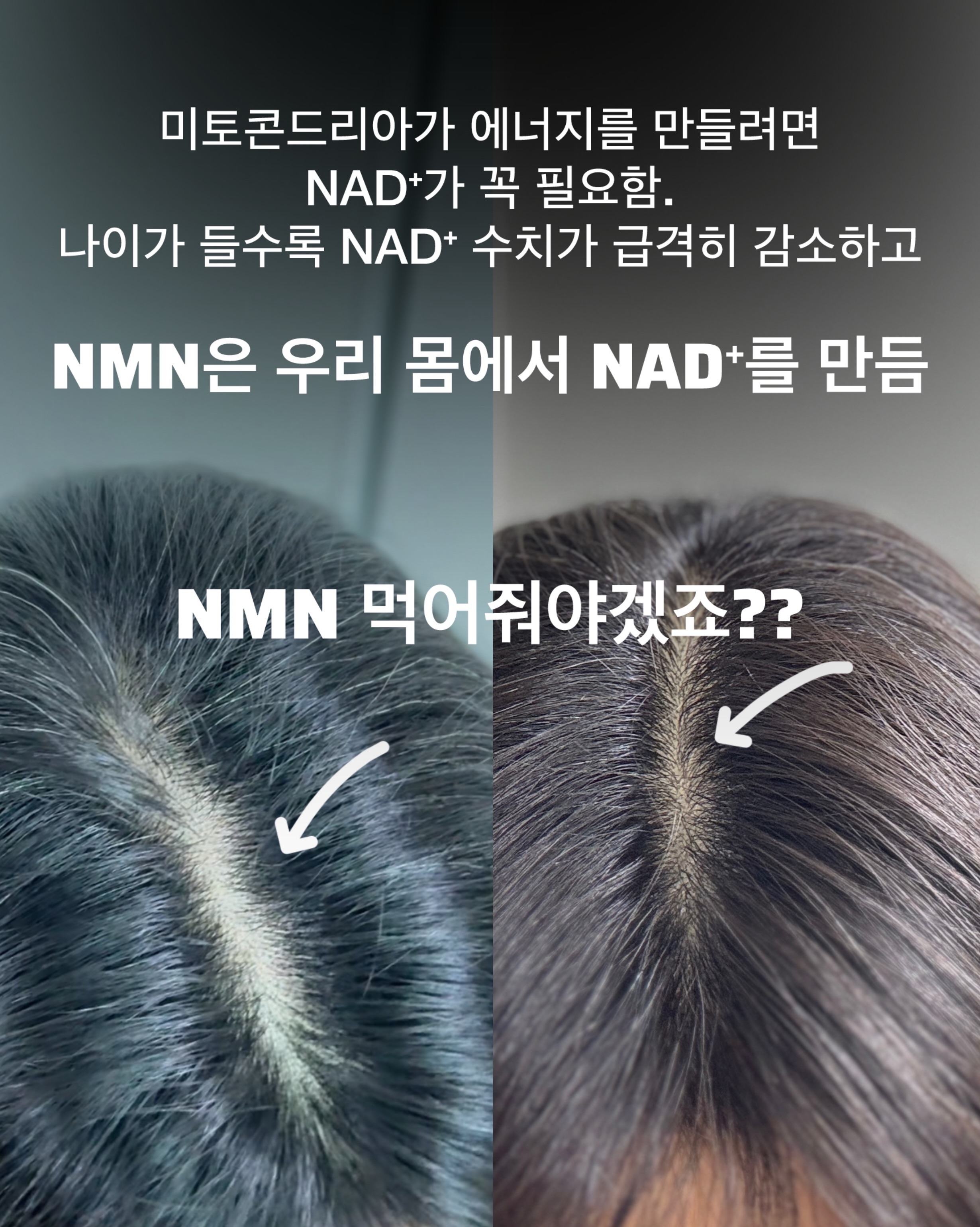 오뜨베베 나시고쟁이상하세트 7