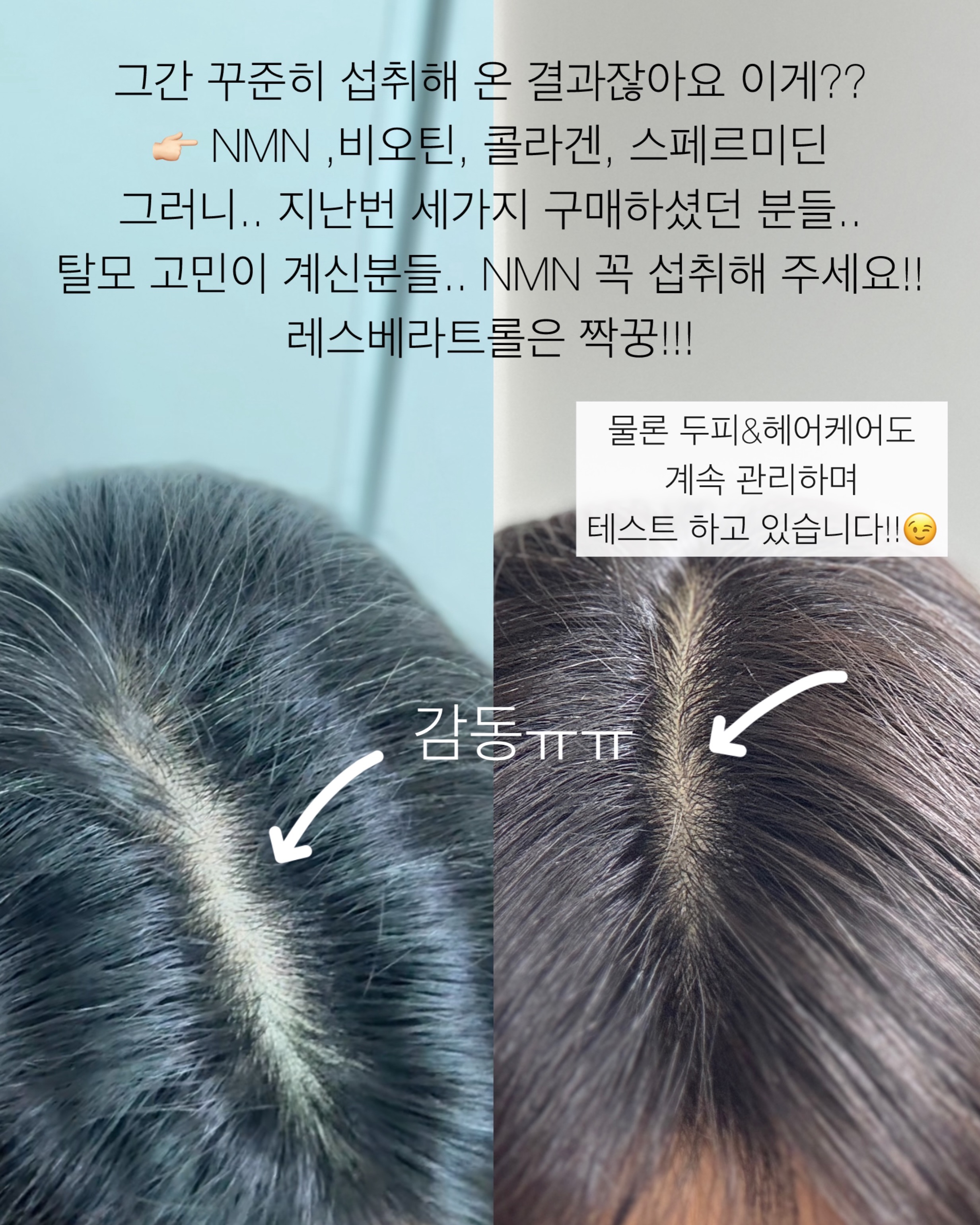 오뜨베베 나시고쟁이상하세트 8