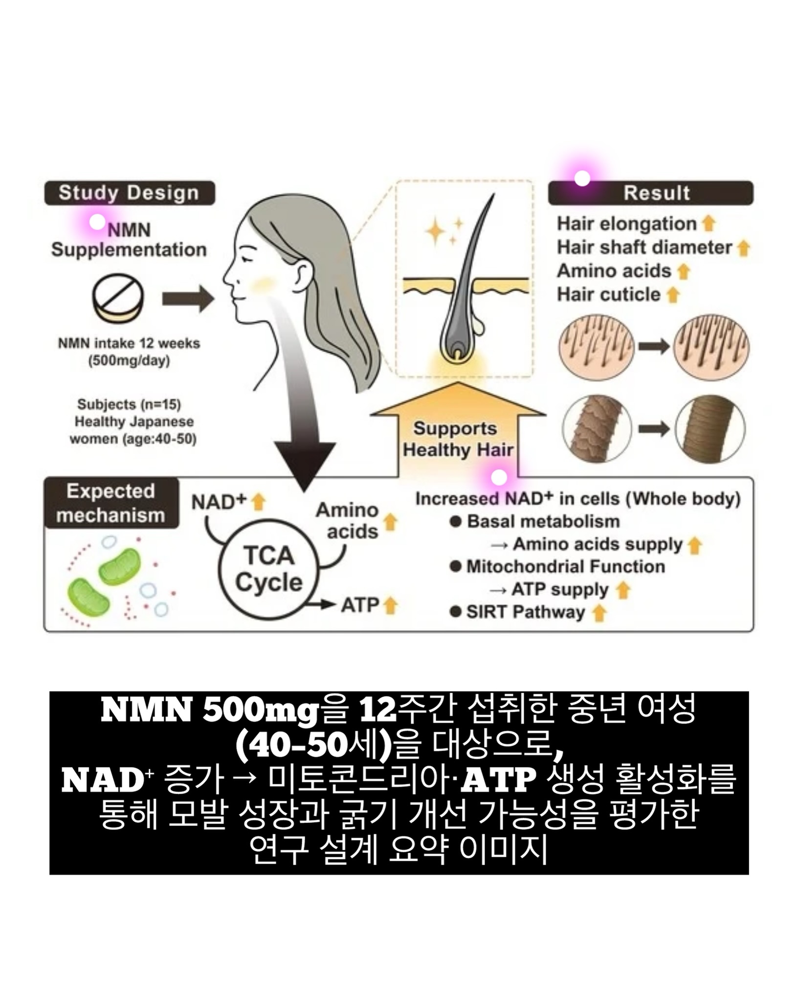 오뜨베베 나시고쟁이상하세트 10