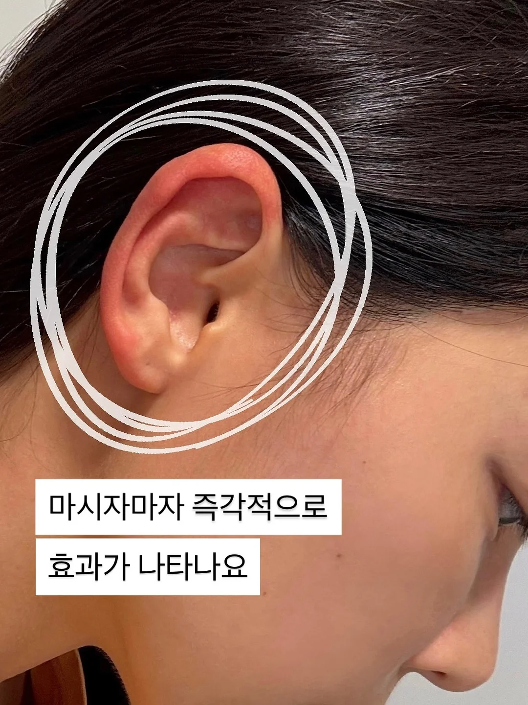 쪼리힐 4