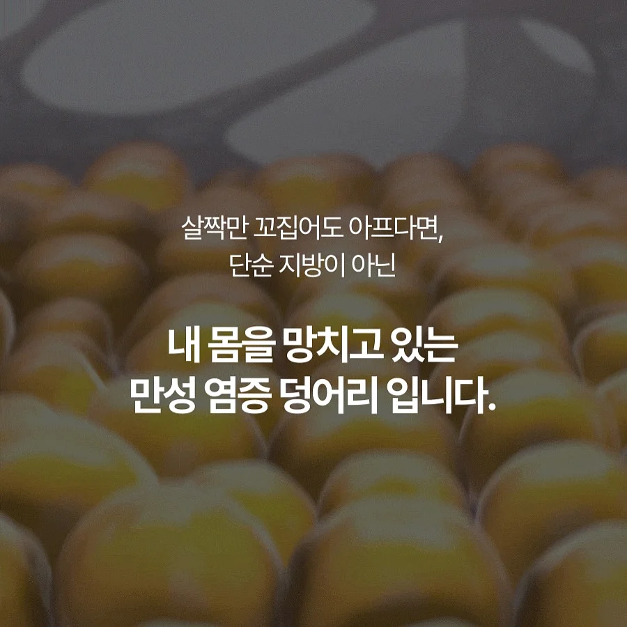 게스 여름 캠페인 의류 5