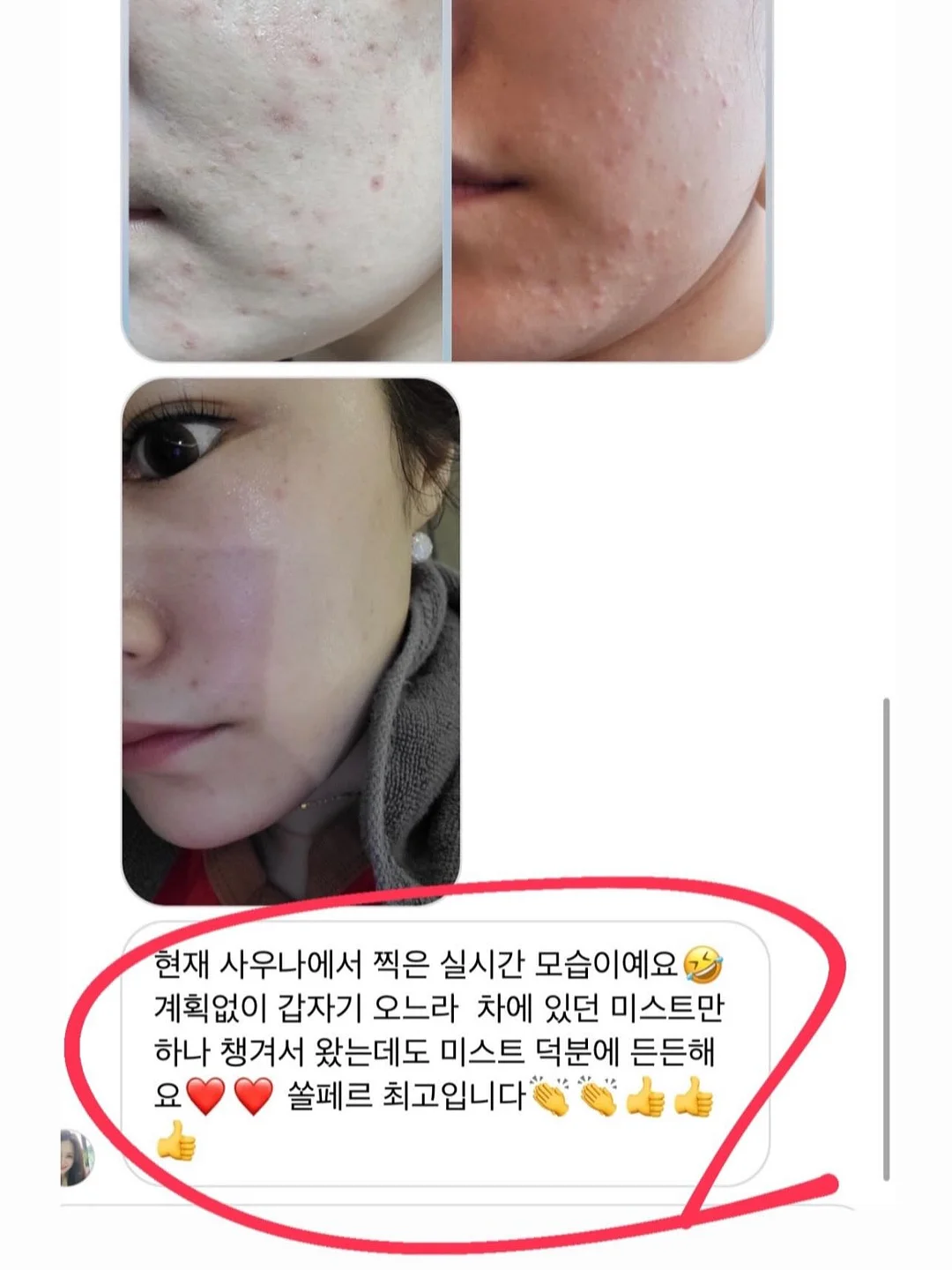 히퍼 4종 16