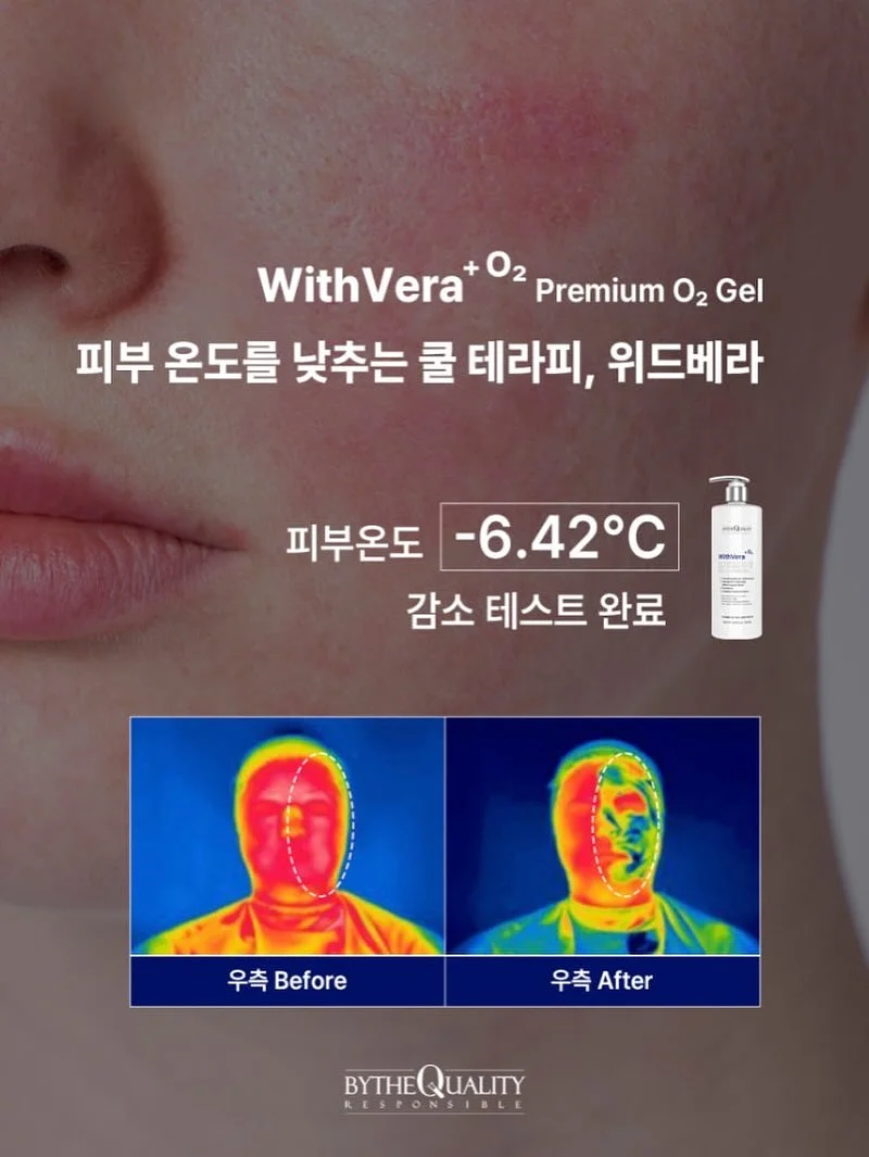 아베크엘 시나몬번 3