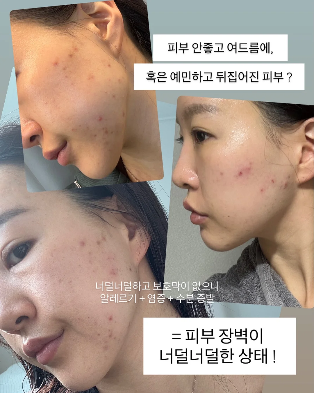 락티브 키즈 오메가3 7