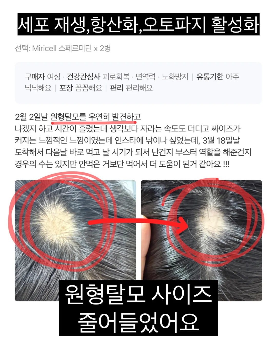여성용 시계 6
