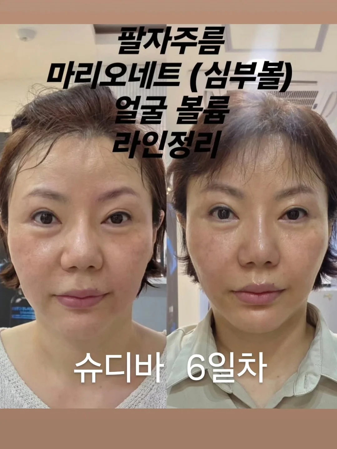 CJ 유기농 케일 1