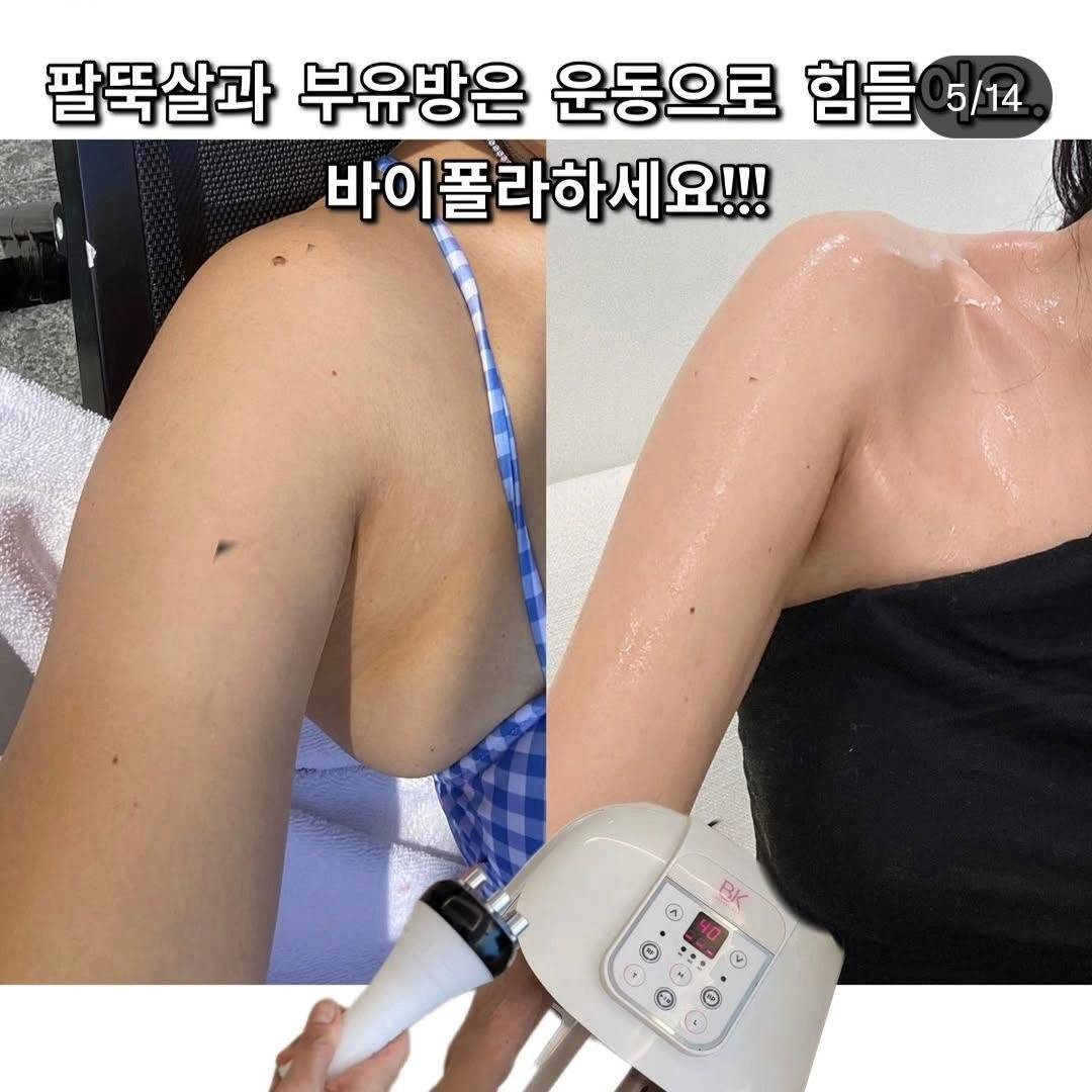 늙기싫다 크림 7