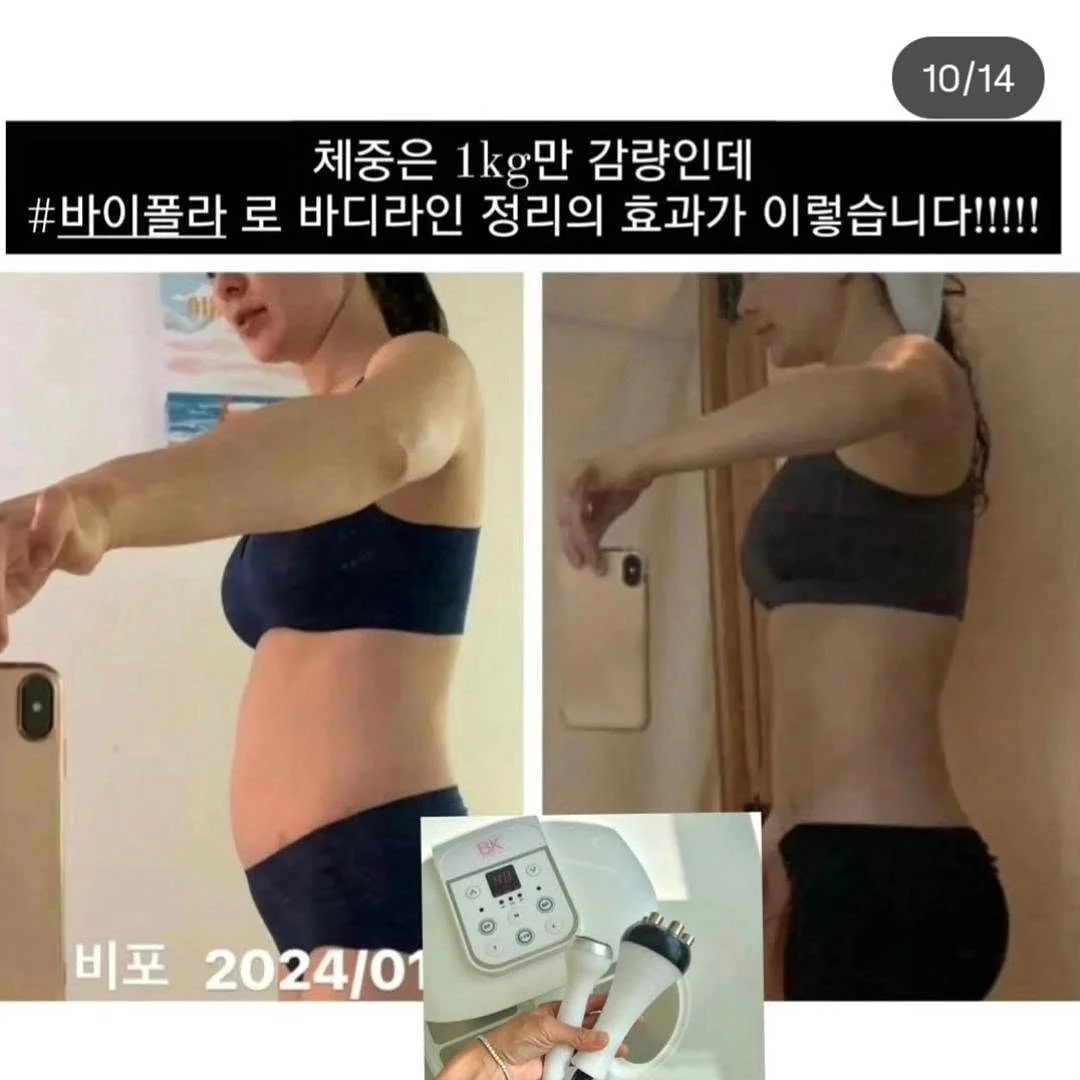 늙기싫다 크림 9