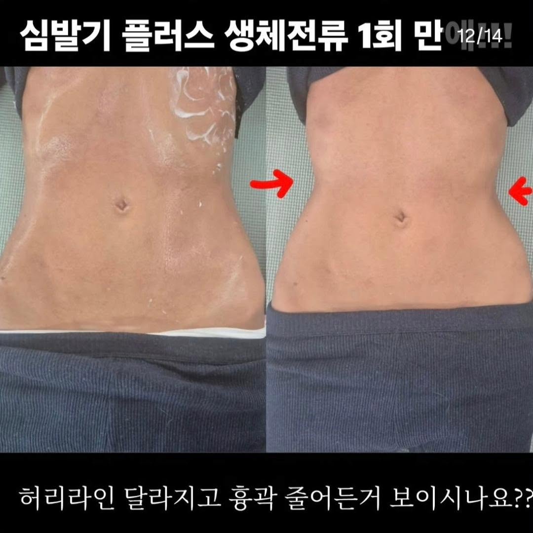 늙기싫다 크림 10