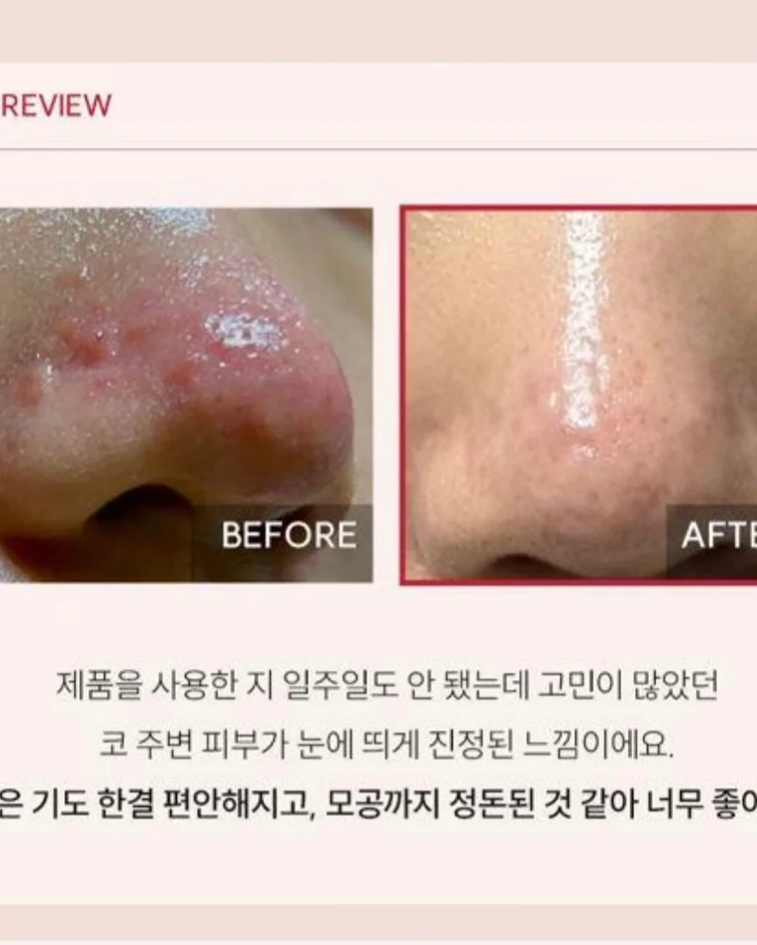 라브리에 징크 무기자차 선로션 15
