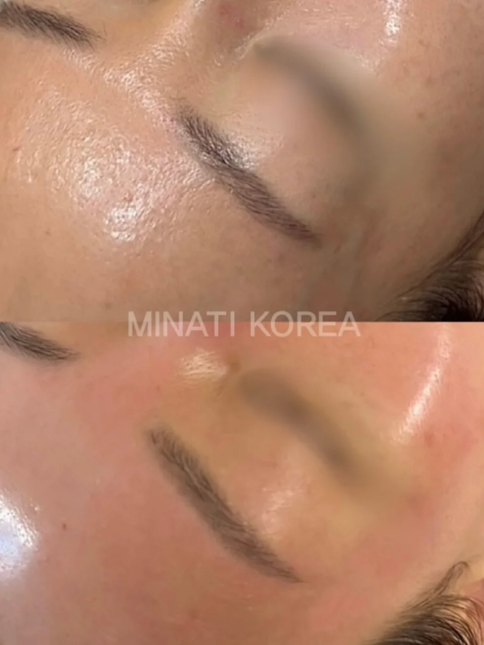 휘카스움베르타 13