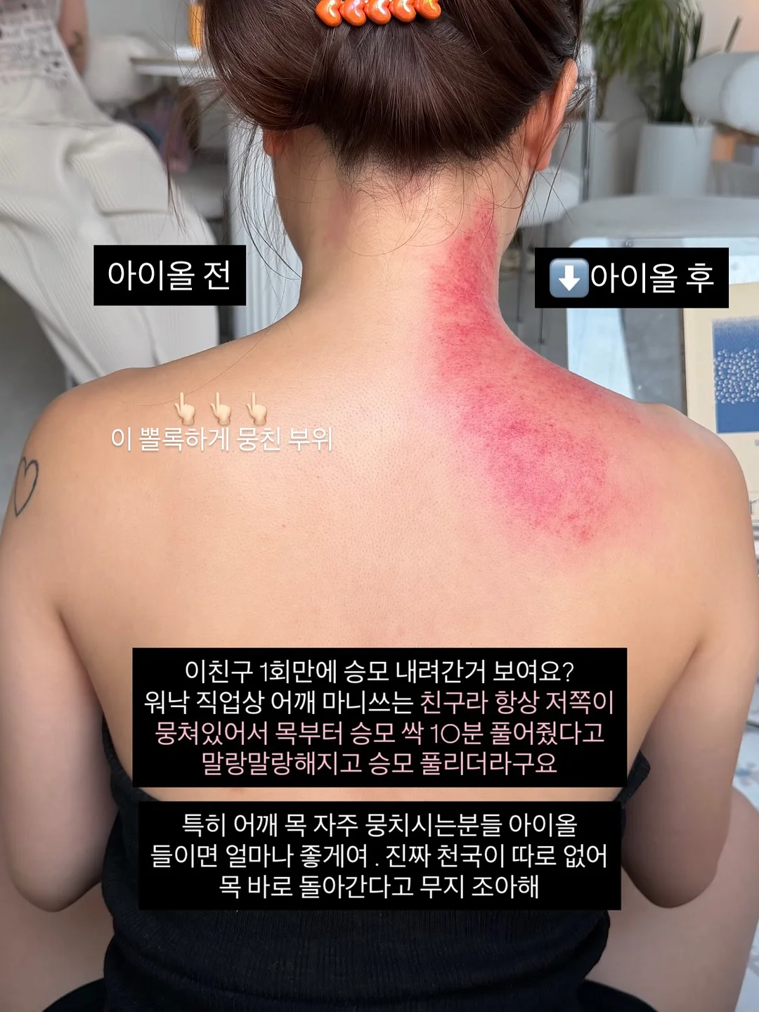 폴로 단가라 카라반팔 4