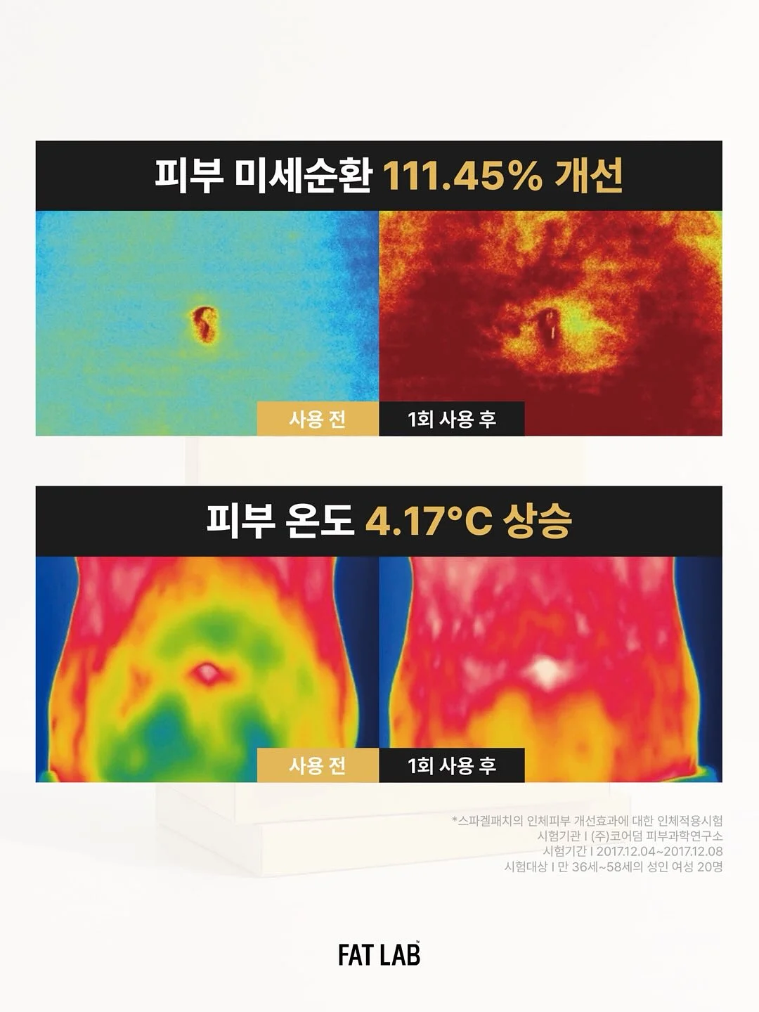 여름 반팔코디 6