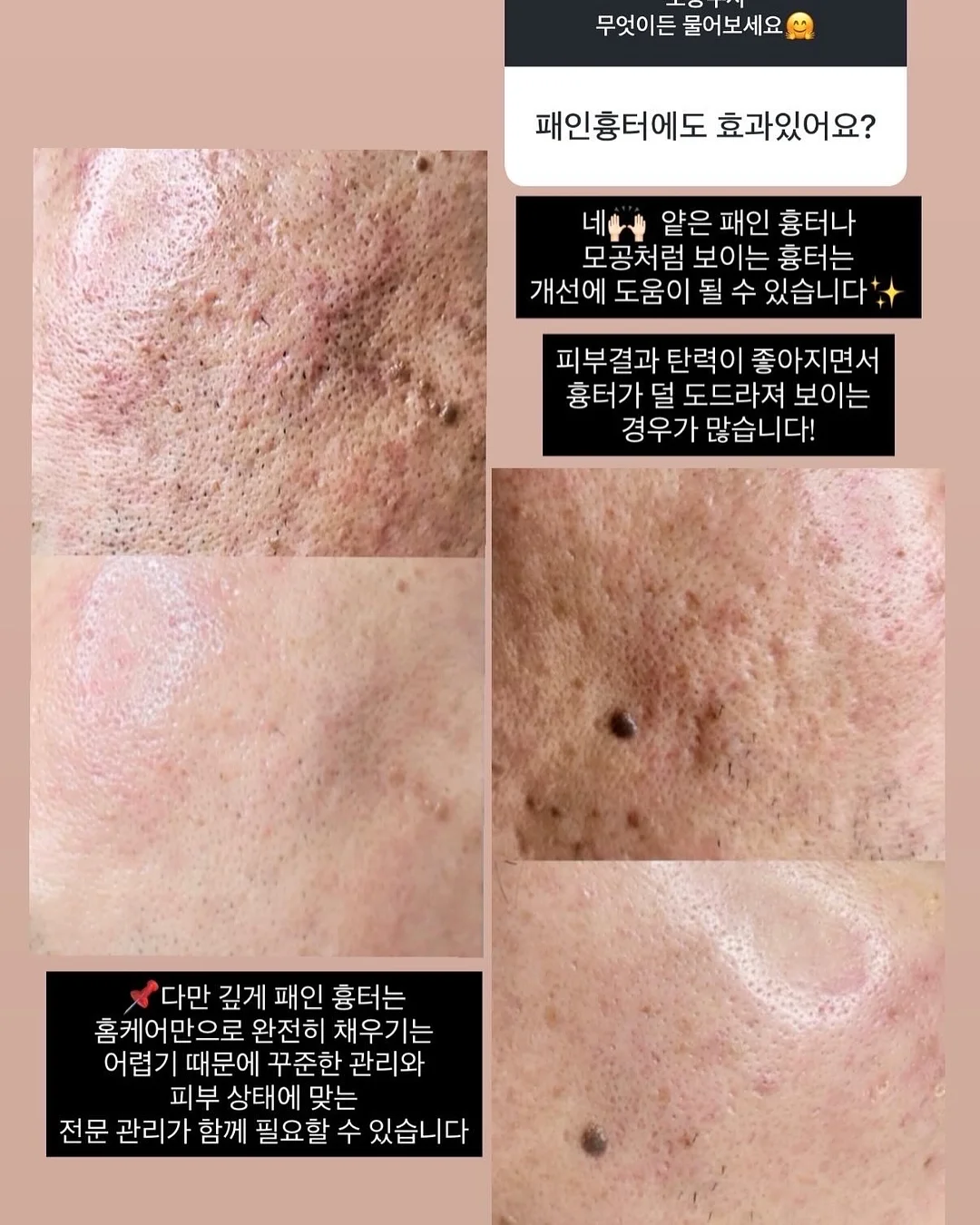 줌 바이 정샘물 메이크업 픽서 50ml 6