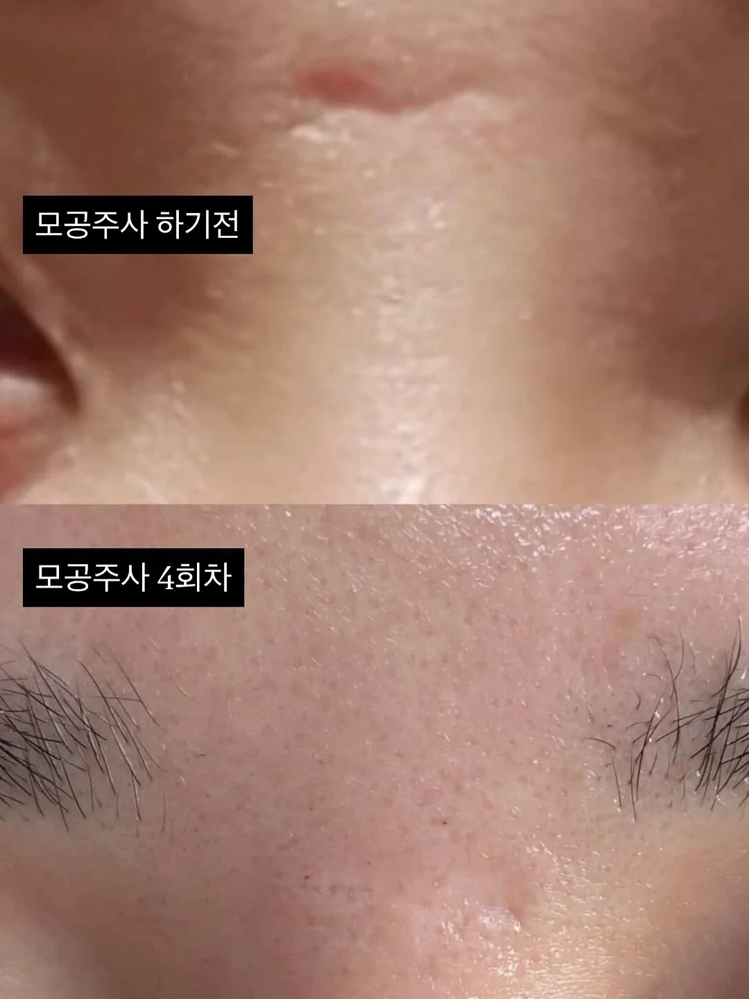 아웃도어프로덕트 코브마스터 반팔 반바지 3