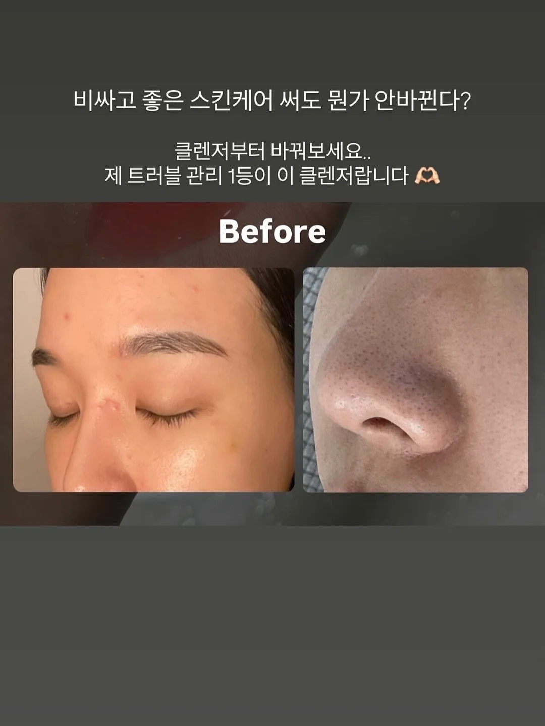 사각 싱크볼 6