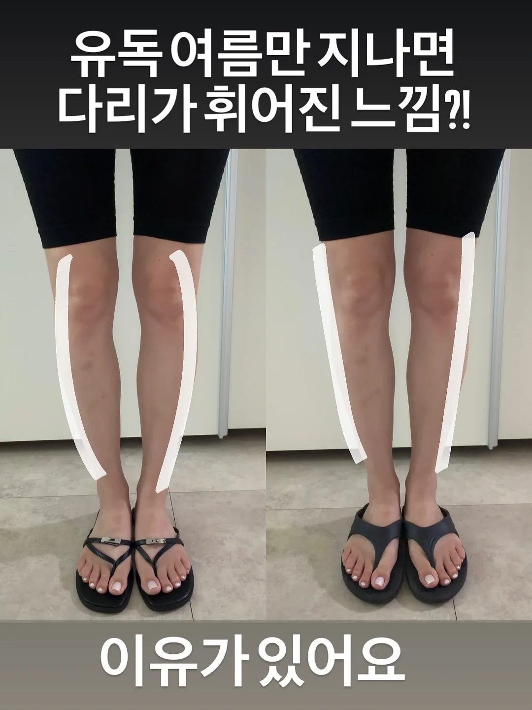압축 양말 1