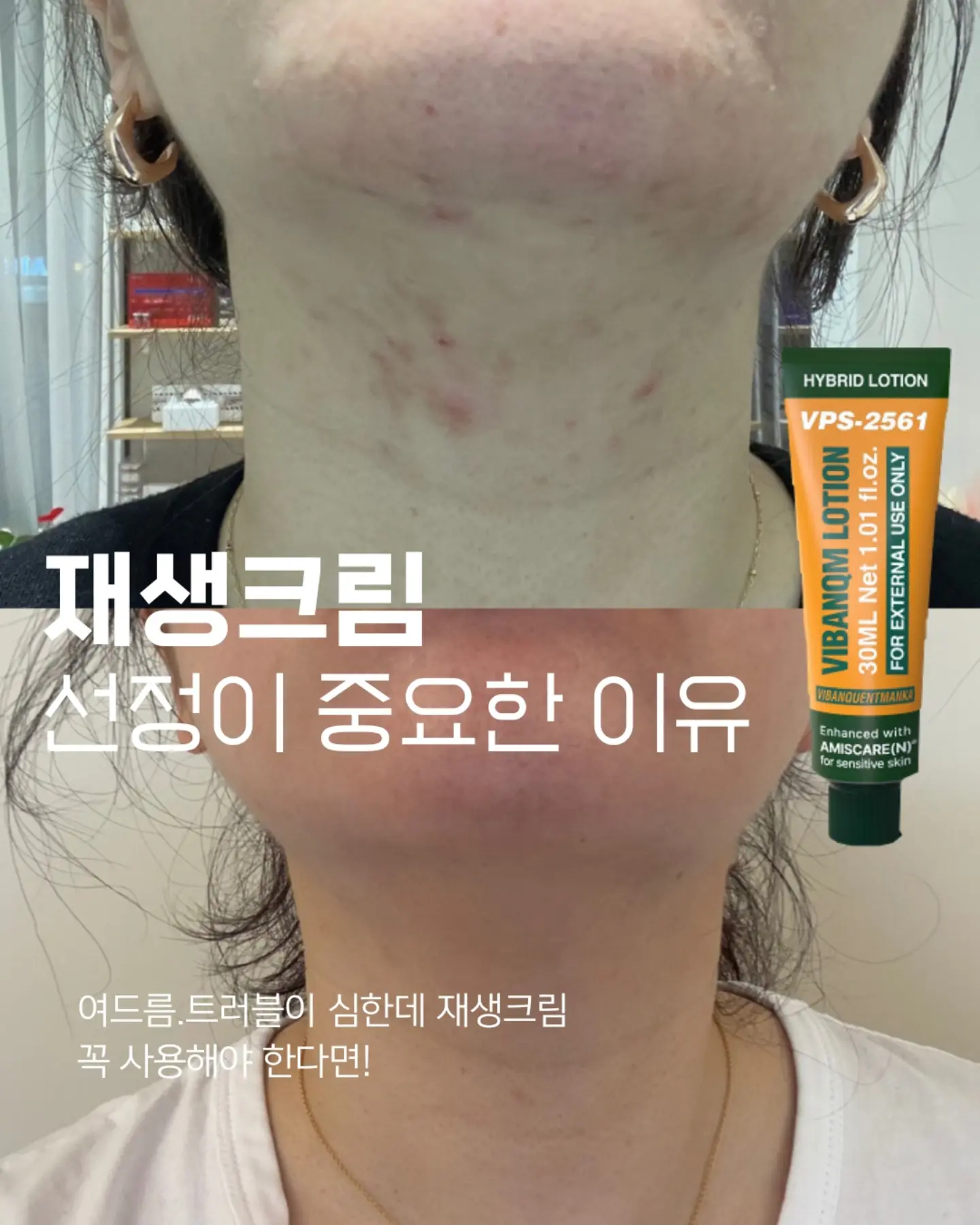 하이큐 카라스노 고교 vs 아오바죠사이 고교 타이토쿠지 1