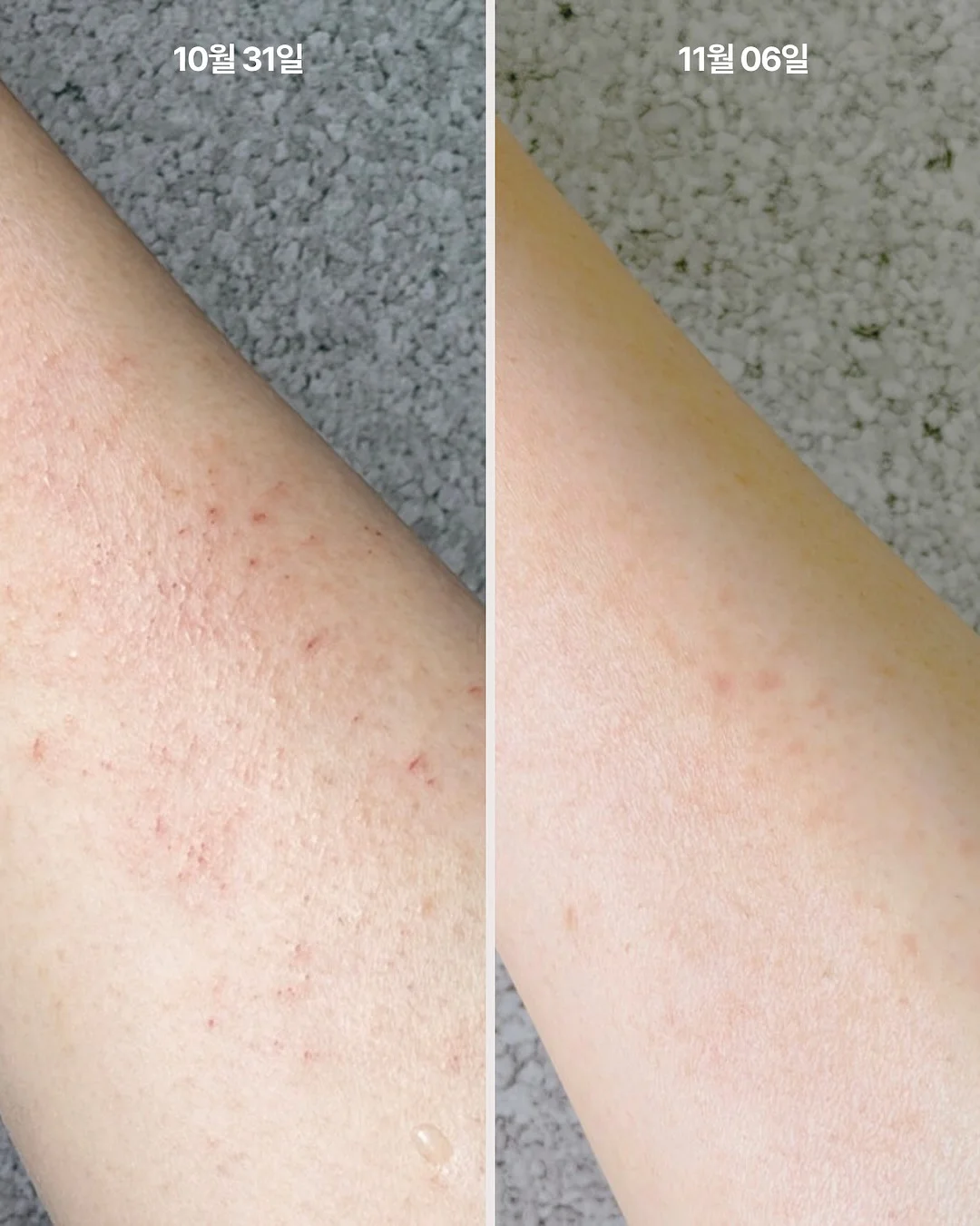 운전 팔 받침대 3