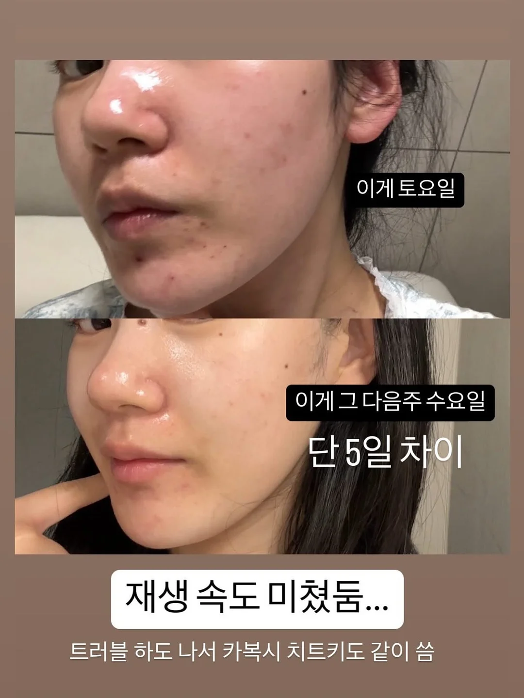 씨드 멤버 7