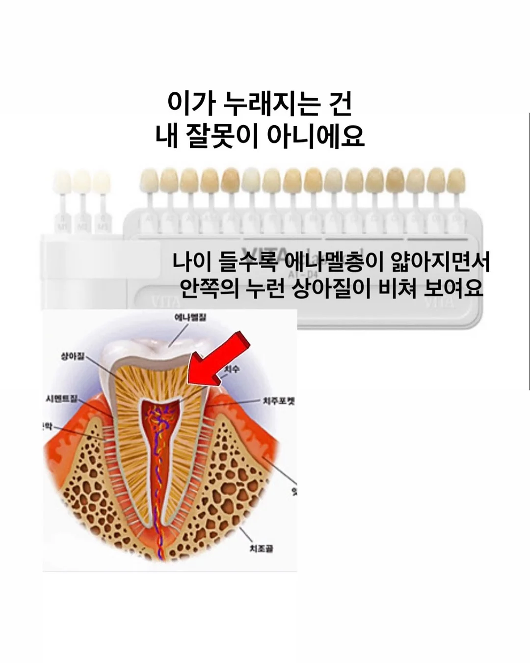 여행용 캐리어 4
