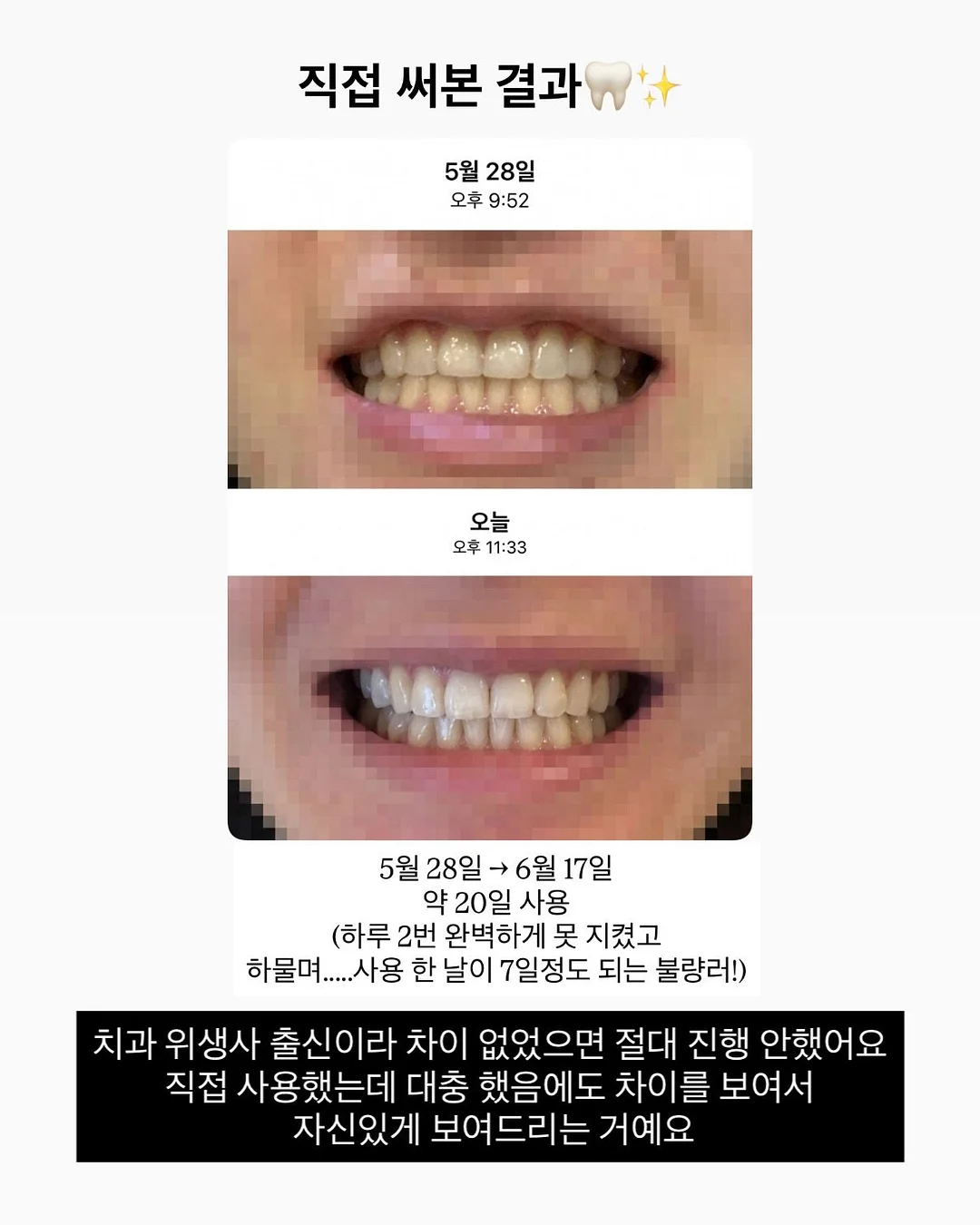 여행용 캐리어 10