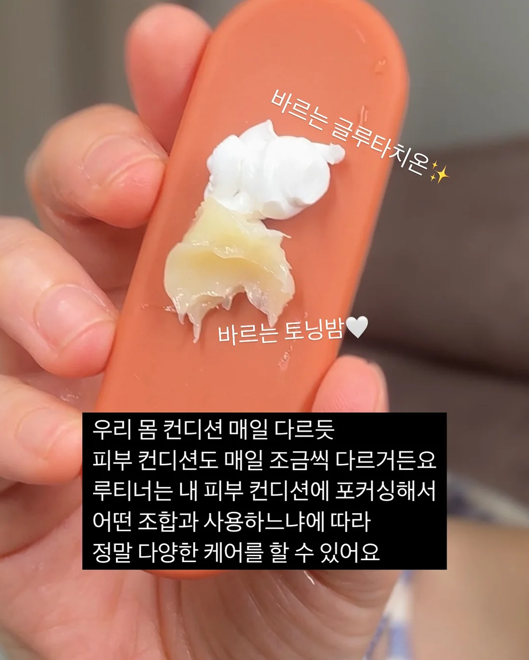 필오프 베이스 시술 8