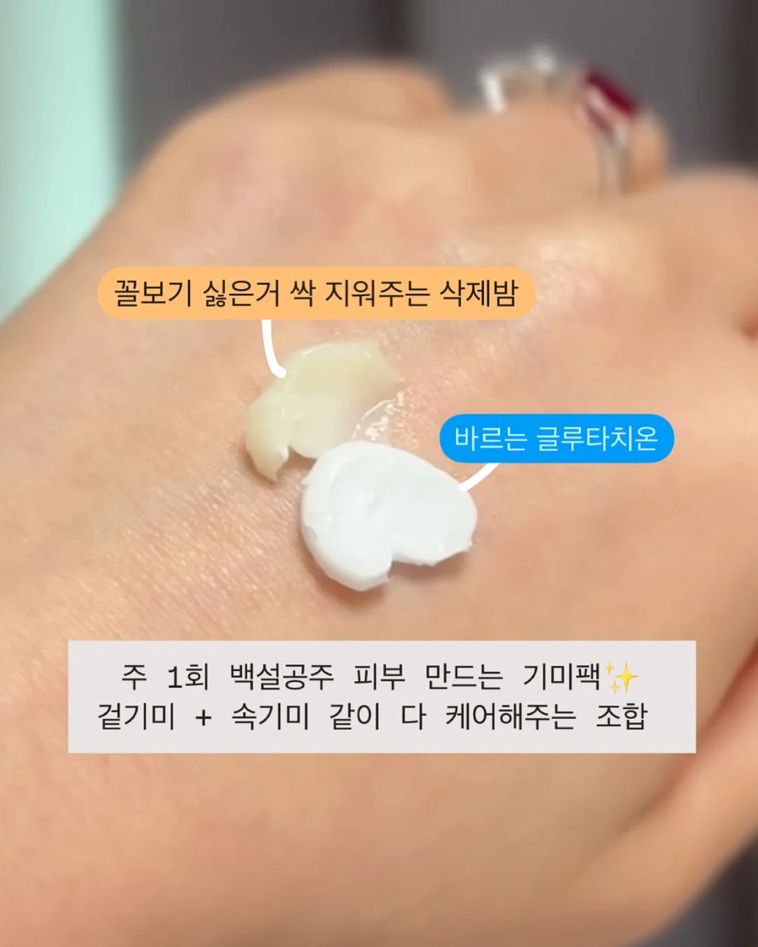 필오프 베이스 시술 9