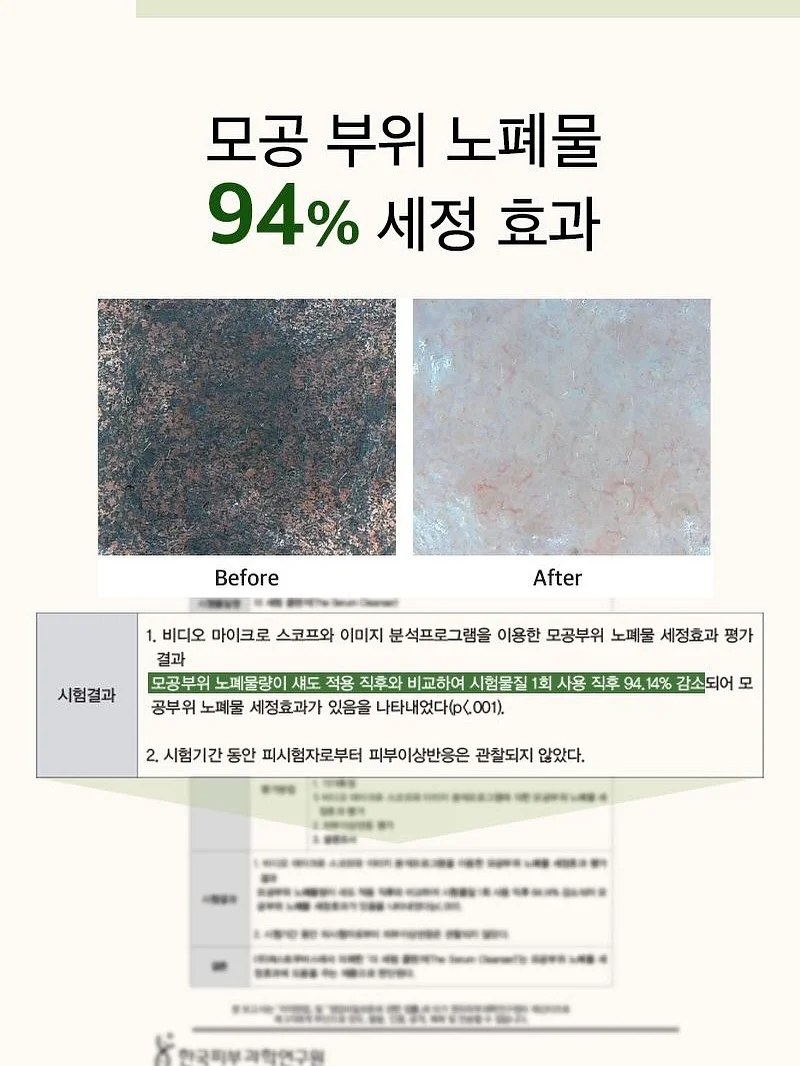 홈톡스 얼음시트 2
