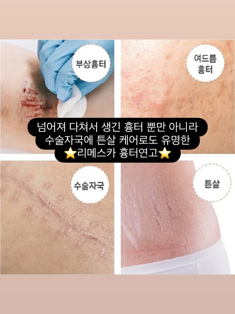 크레모아 아이스팬 5
