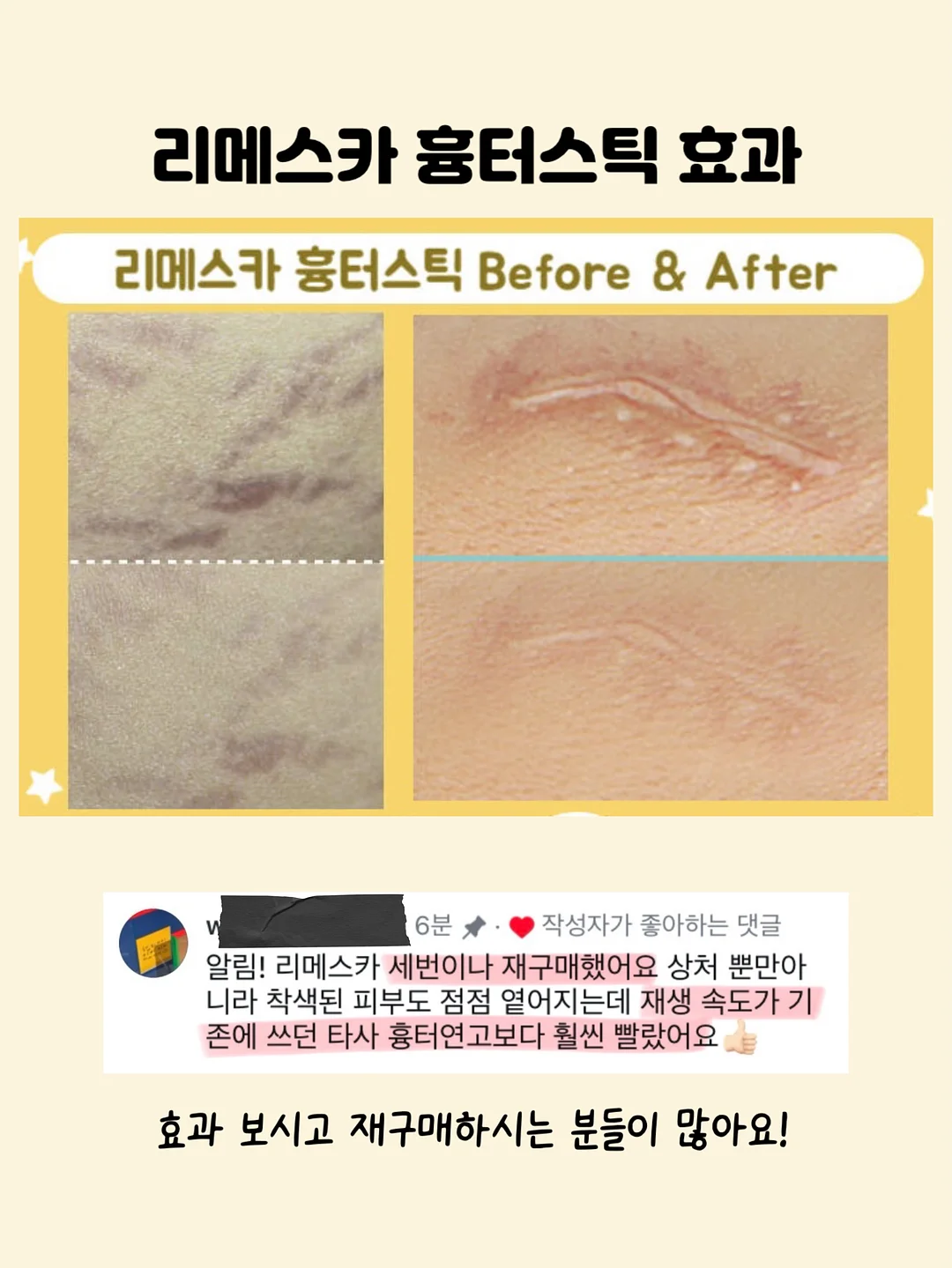 크레모아 아이스팬 7