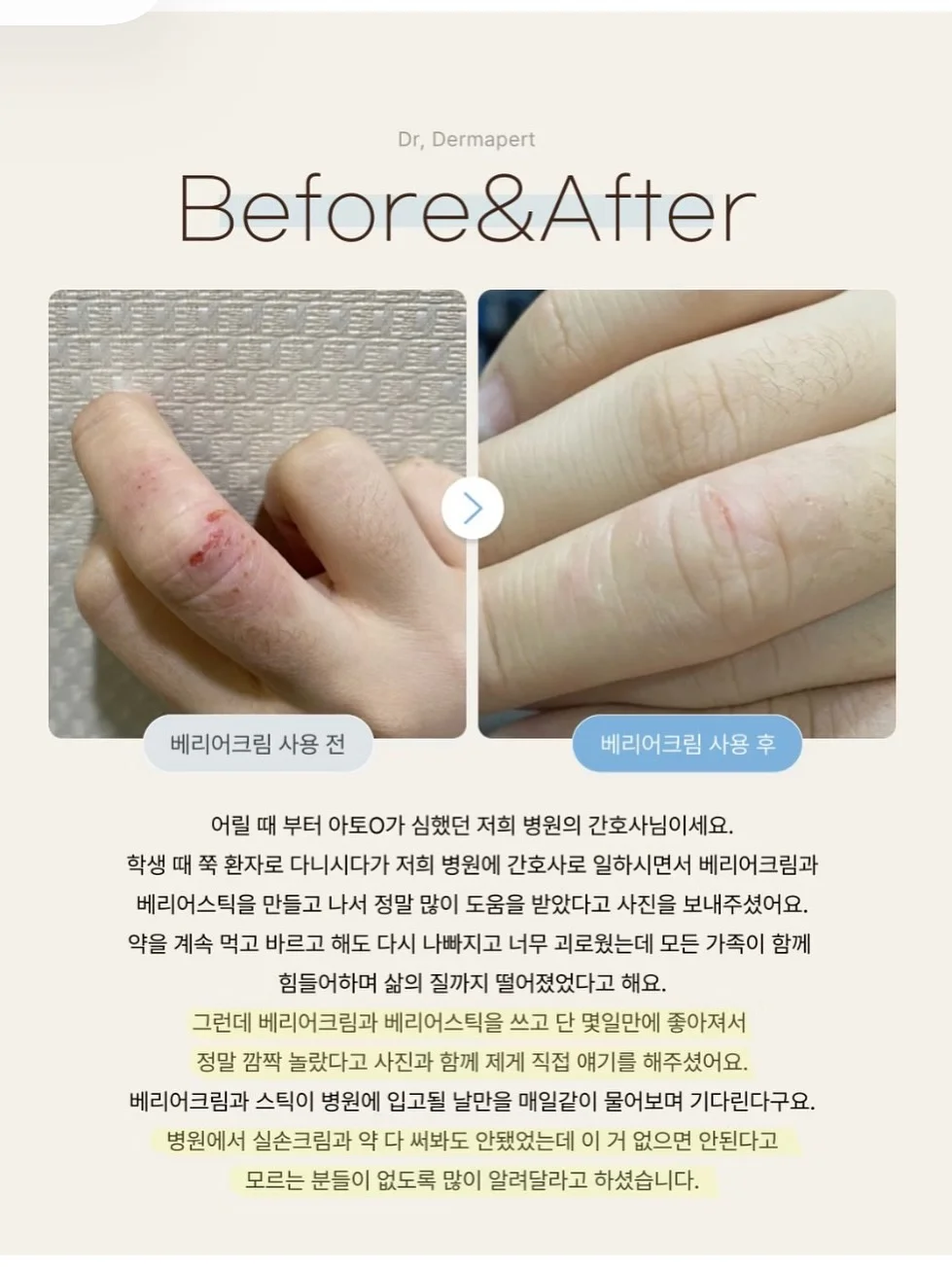 새둥지 양배추전 레시피 13