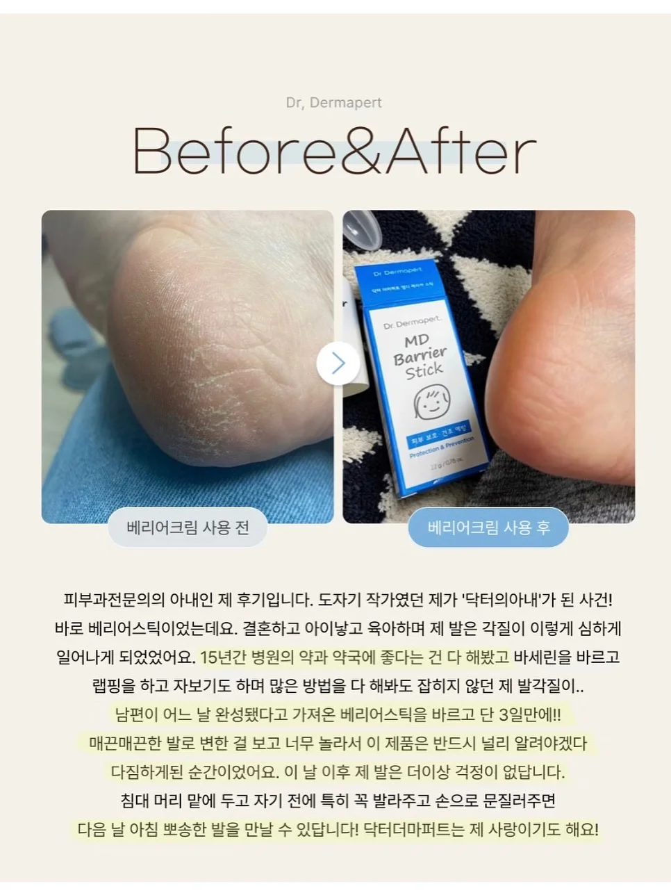 새둥지 양배추전 레시피 14